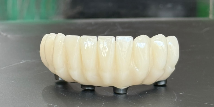 Lucrare full-arch din zirconiu pentru încărcare imediată, văzută vestibular