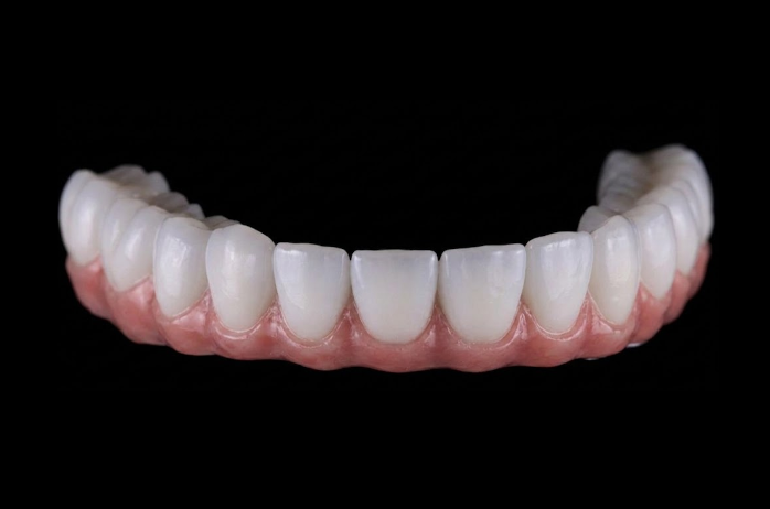 Lucrare All on 4/6 pe implant din zirconiu — laborator tehnică dentară București
