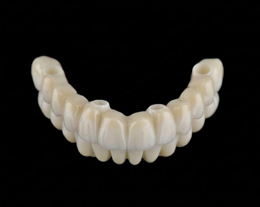 Lucrare Easy Anatomic din PMMA / compozit — laborator tehnică dentară București