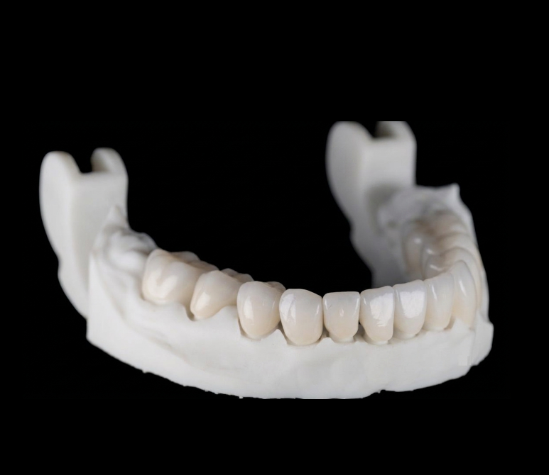Punte fizionomică din zirconiu pe model — Full Anatomic, laborator București