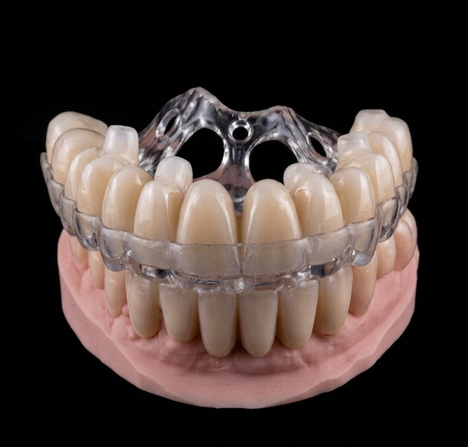Ghid chirurgical stackable transparent pe model — chirurgie ghidată, laborator București