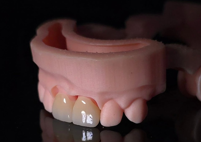 Lucrare fizionomică pe model printat 3D — Full Anatomic, laborator Râmnicu Vâlcea