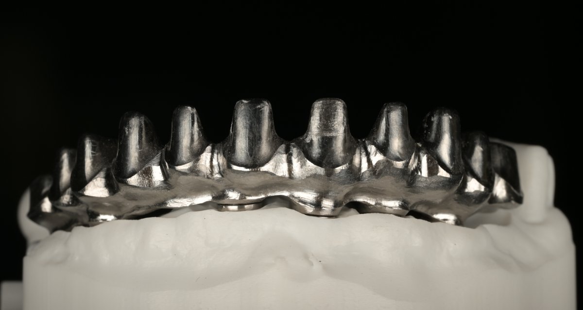 Structură de titan pe model, lucrare All on 4/6 — laborator Timișoara