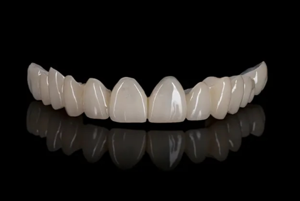 Lucrare Easy Anatomic din PMMA / compozit — laborator tehnică dentară Timișoara