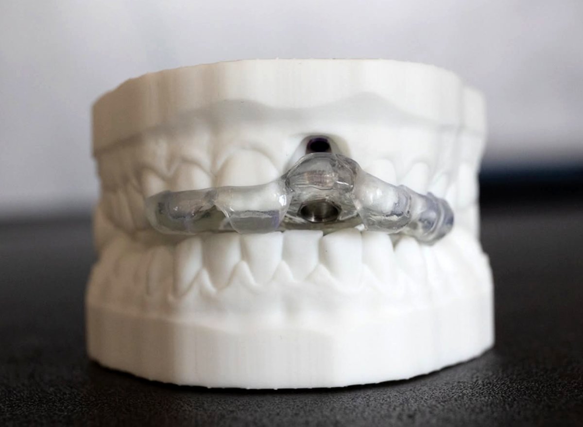 Ghid chirurgical stackable 3DentaGuide pentru All on 4/6 — laborator Timișoara